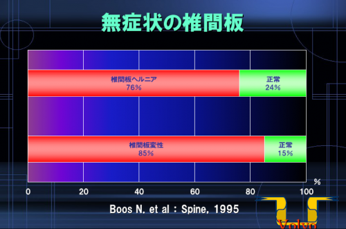 無症状の椎間板.png