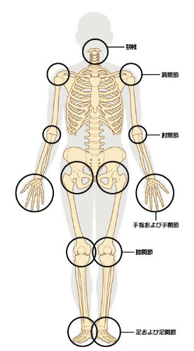 全身の関節 (1).jpeg