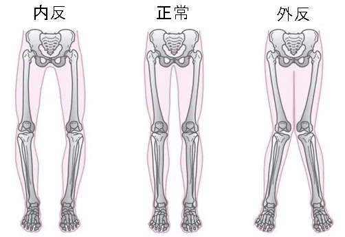 外反・内反膝 (1).jpeg