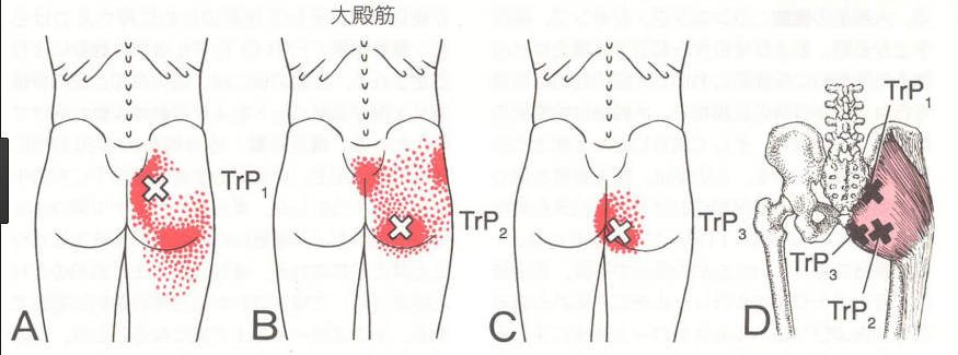 大臀筋トリカ?ーホ?イント.png